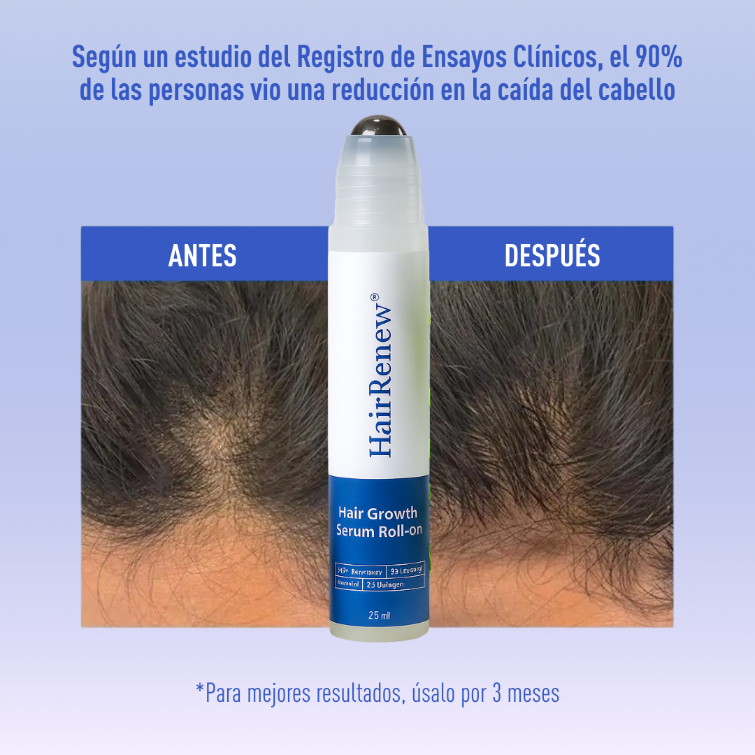 HairRenew™ – Crecimiento capilar fácil y natural