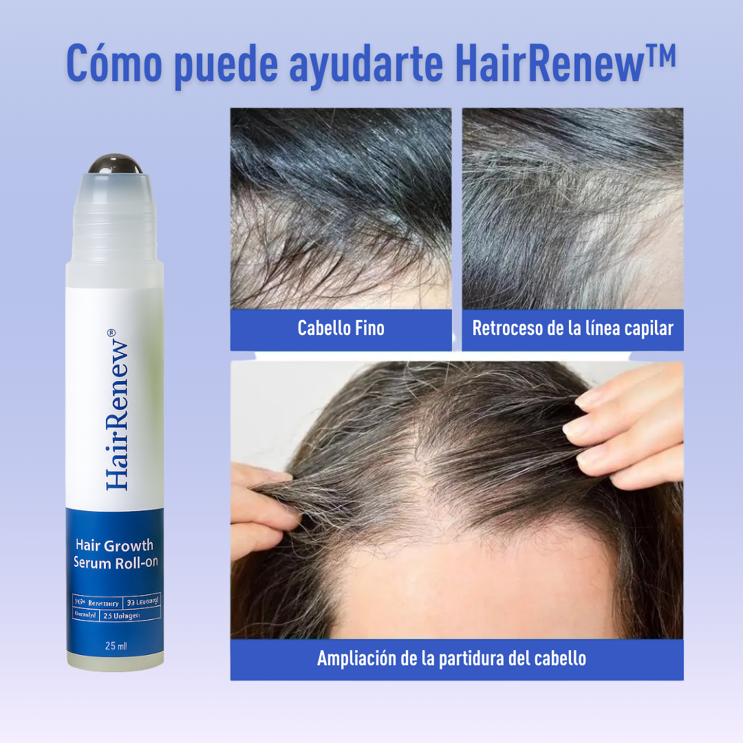 HairRenew™ – Crecimiento capilar fácil y natural