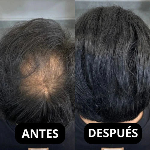CoverMax™ – Camuflaje Capilar Profesional