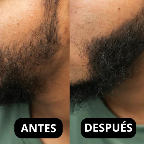 CoverMax™ – Camuflaje Capilar Profesional