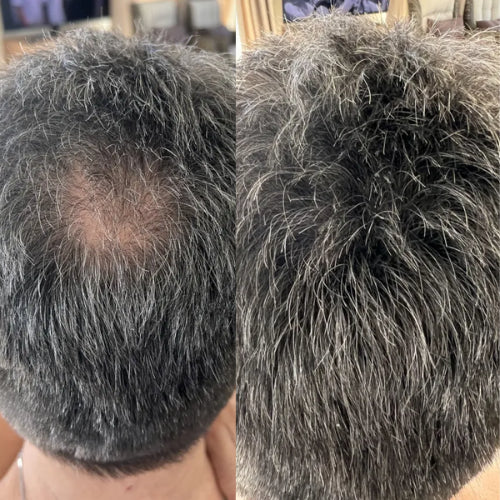 CoverMax™ – Camuflaje Capilar Profesional